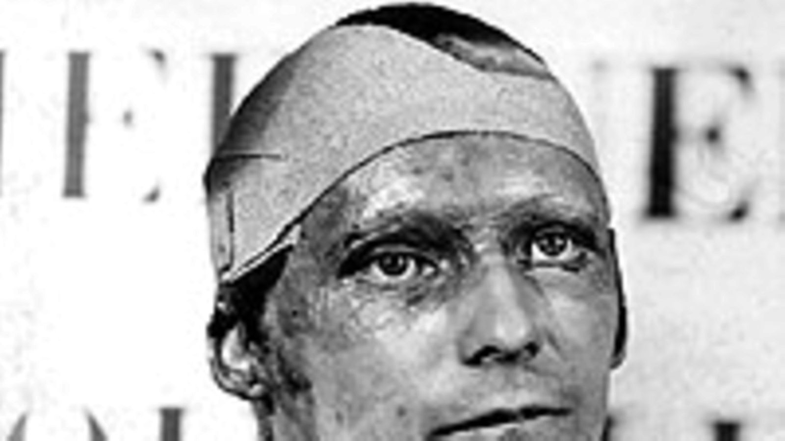 Niki Lauda 6 viikkoa Nürburgringin jälkeen (Photo: Allsport Hulton/Archive)