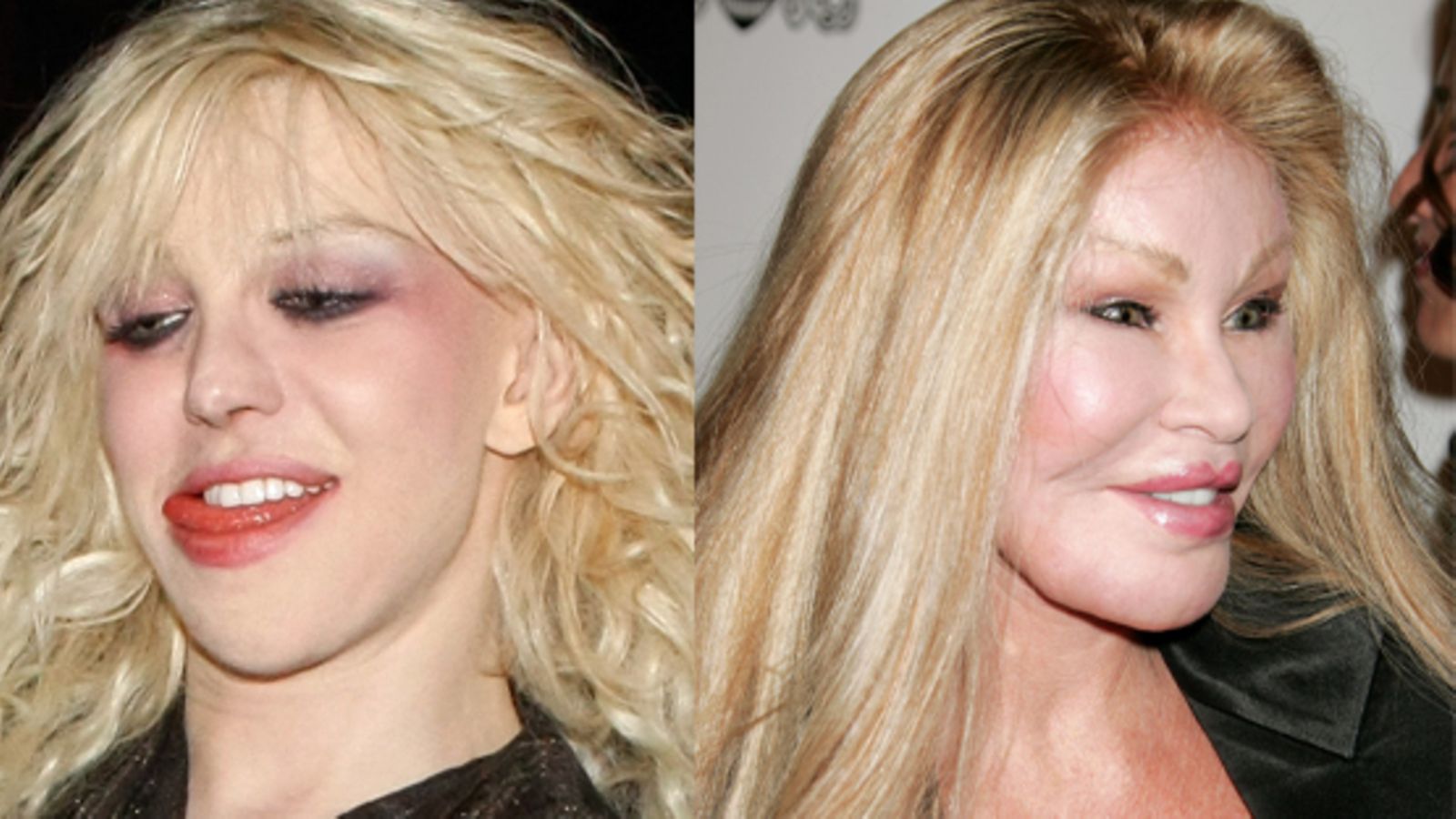 Courtney Love/Jocelyn Wildenstein (kuva: Getty Images)