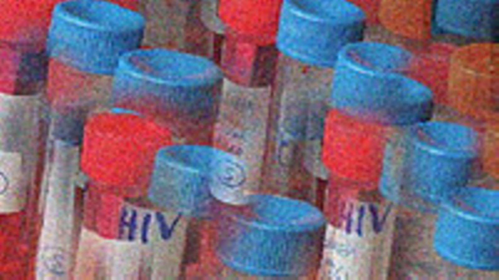 HIV