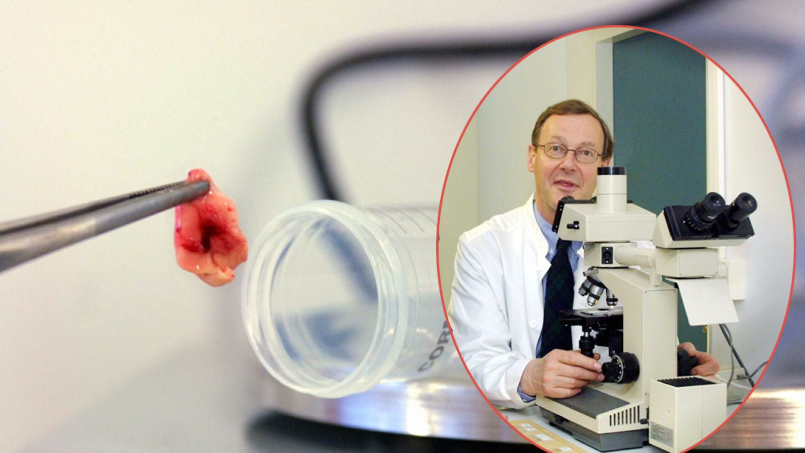 Professori Matti Haltian mukaan Creutzfeldt-Jakobin -taudilla ja hullun lehmän taudilla ei ole kuin luokittelullinen yhteys.
