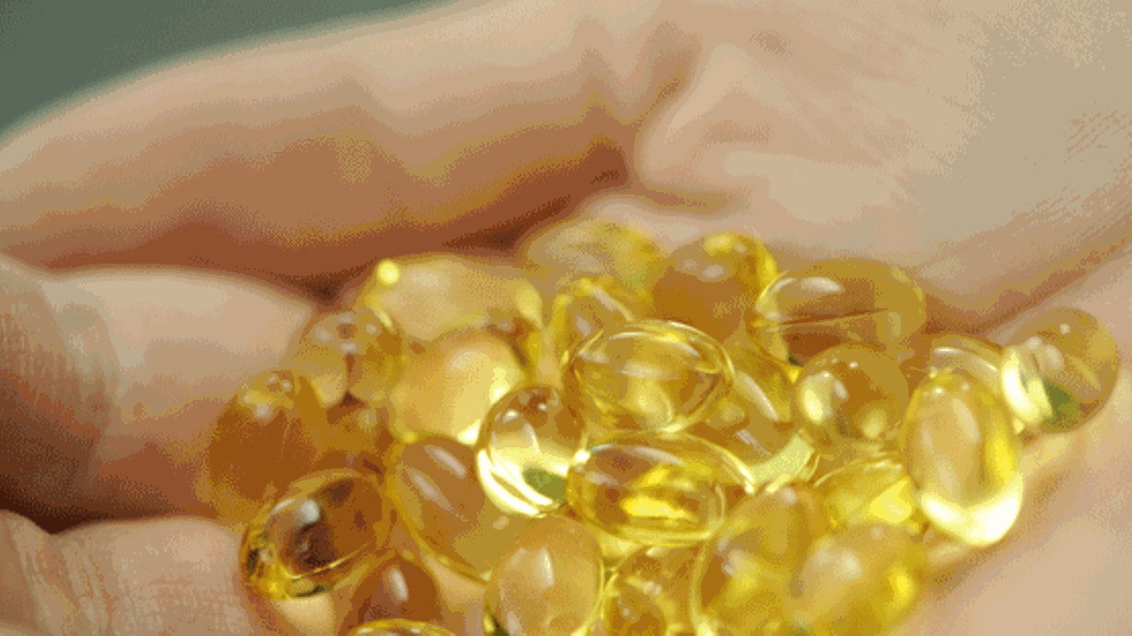 Omega 3:n käyttö voi lisätä verenvuotoa leikkauksissa.
