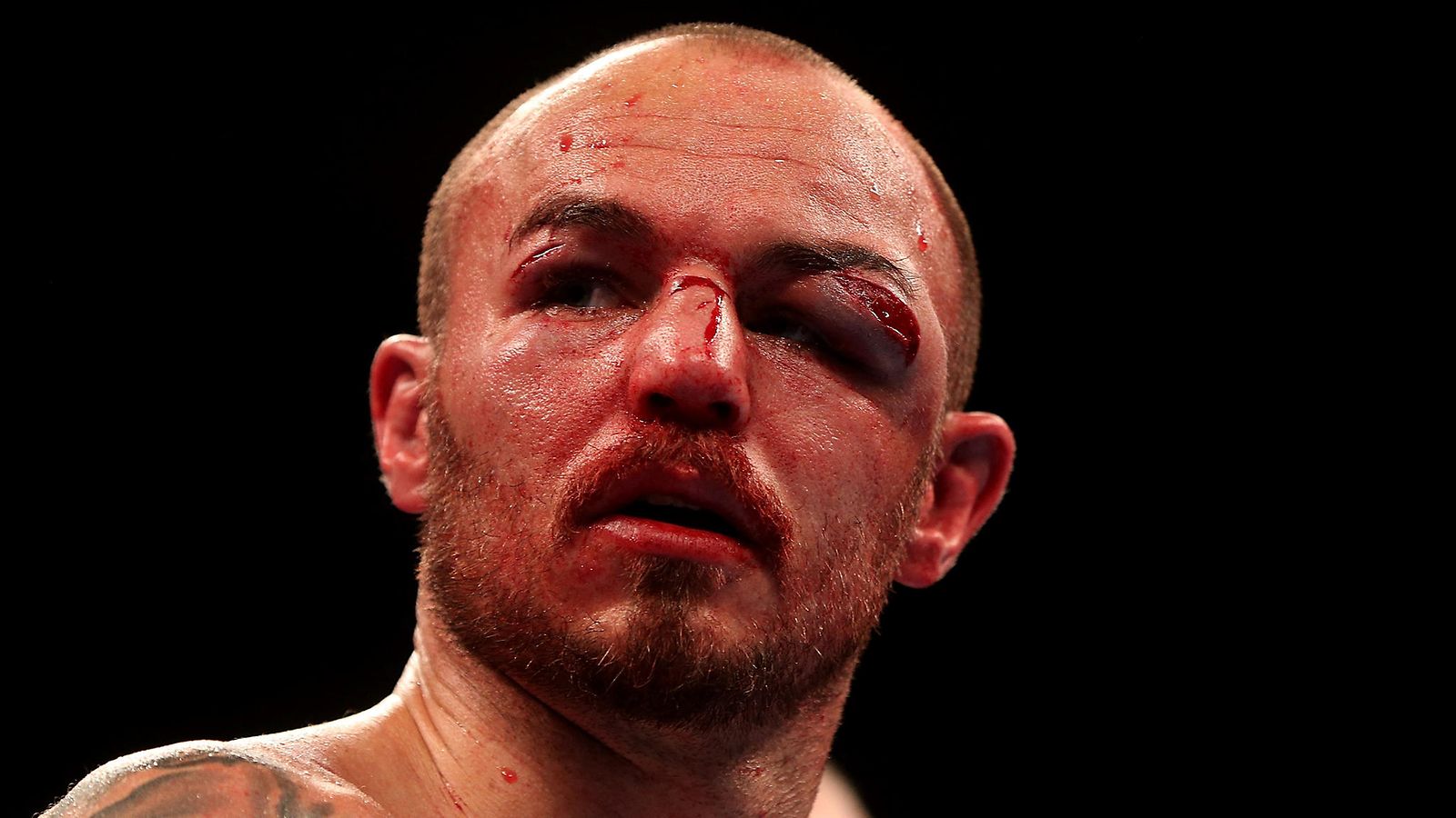 Kevin Mitchell vs Jorge Linares (2)