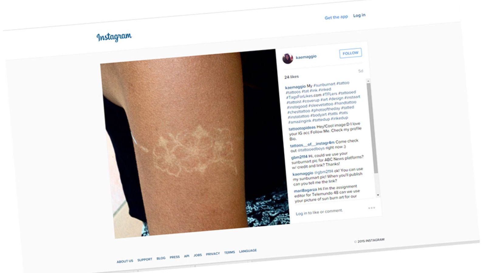 Sunburnart