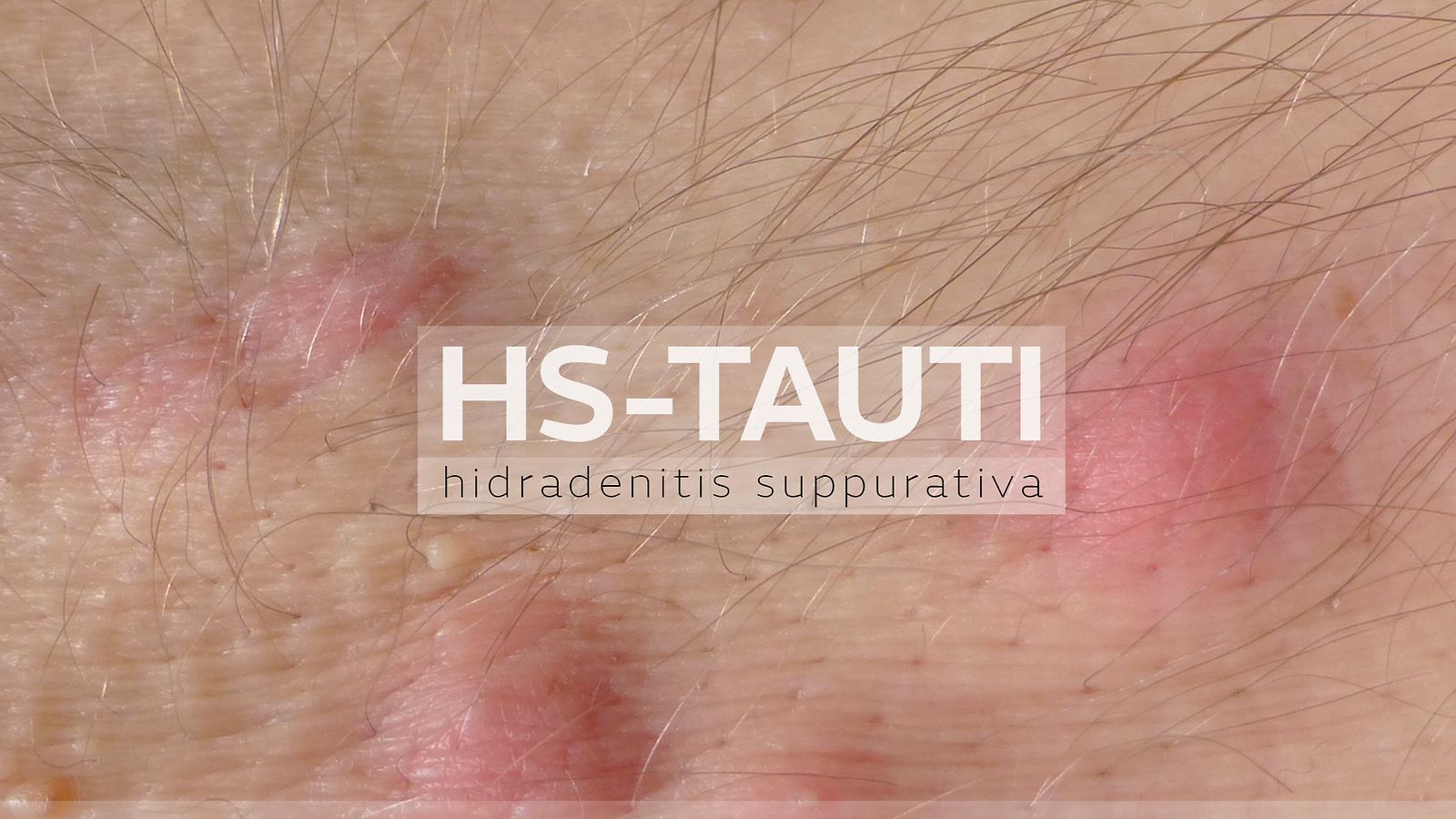 hstauti_header