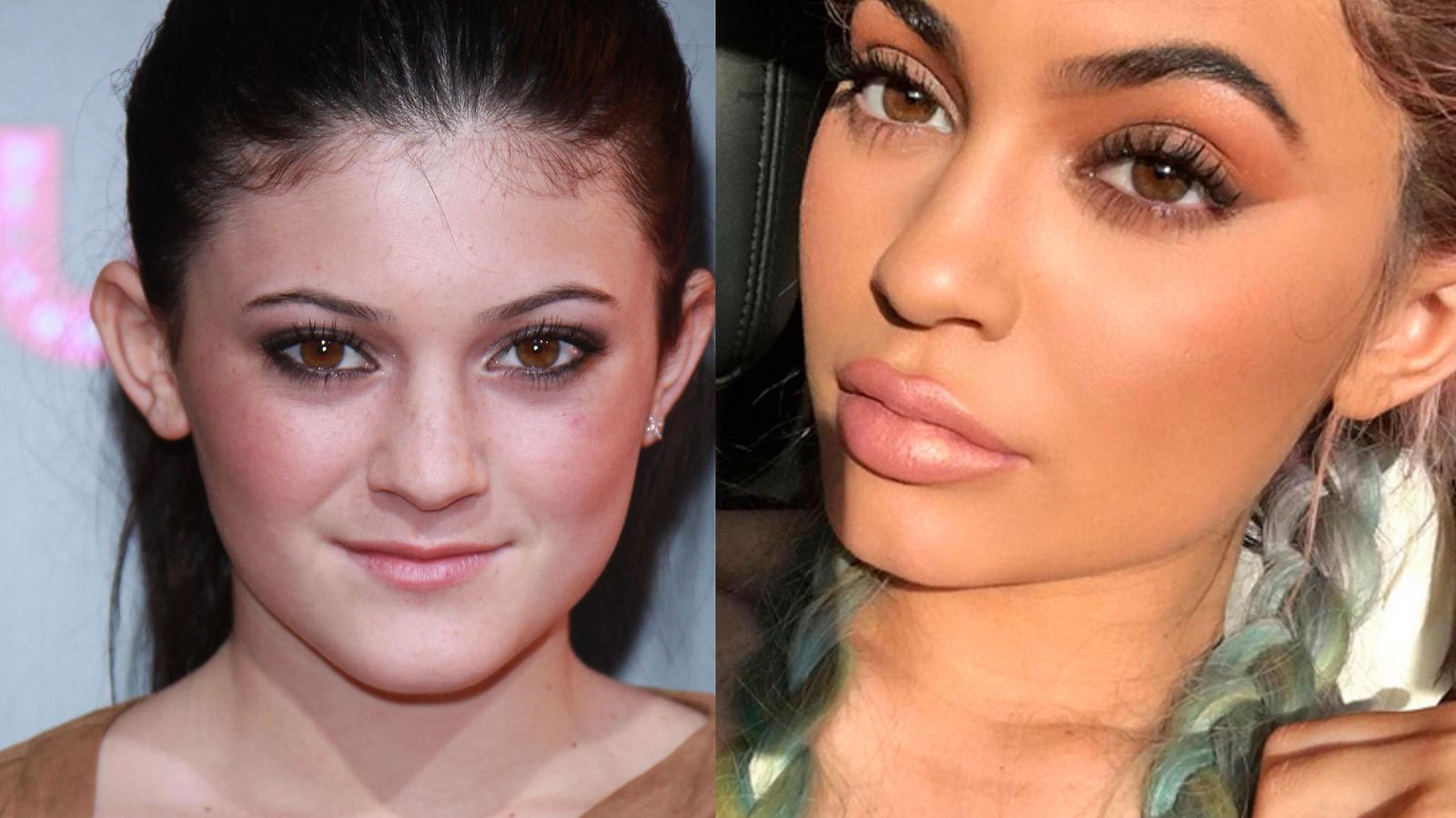 Kylie Jenner Metamorfoosi