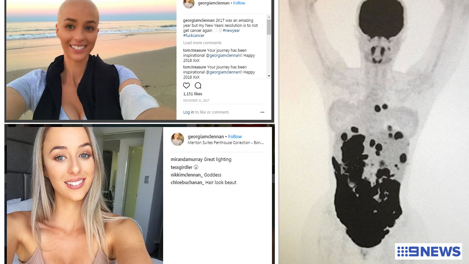 KuvienlähdeInstagramja9news