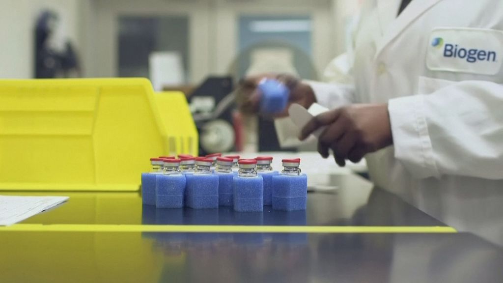 Alzheimer-tutkimuksessa eletään nyt kultakautta – luvassa varhaisempaa diagnosointia ja uusia lääkkeitä