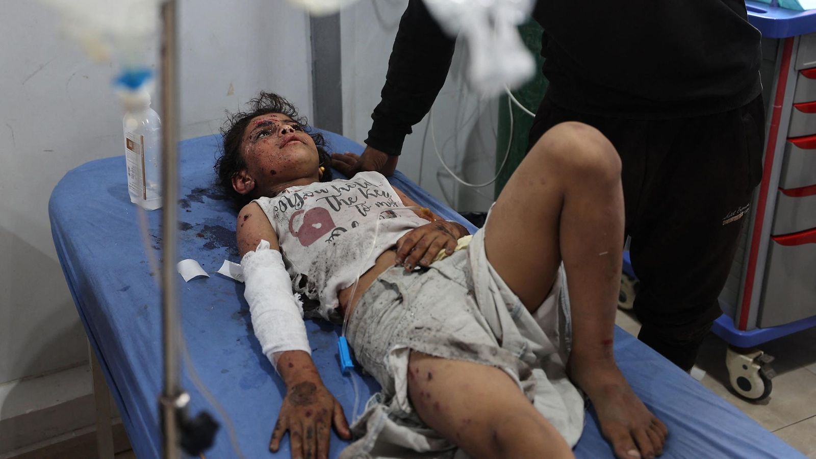 Gaza haavoittunut tyttö
