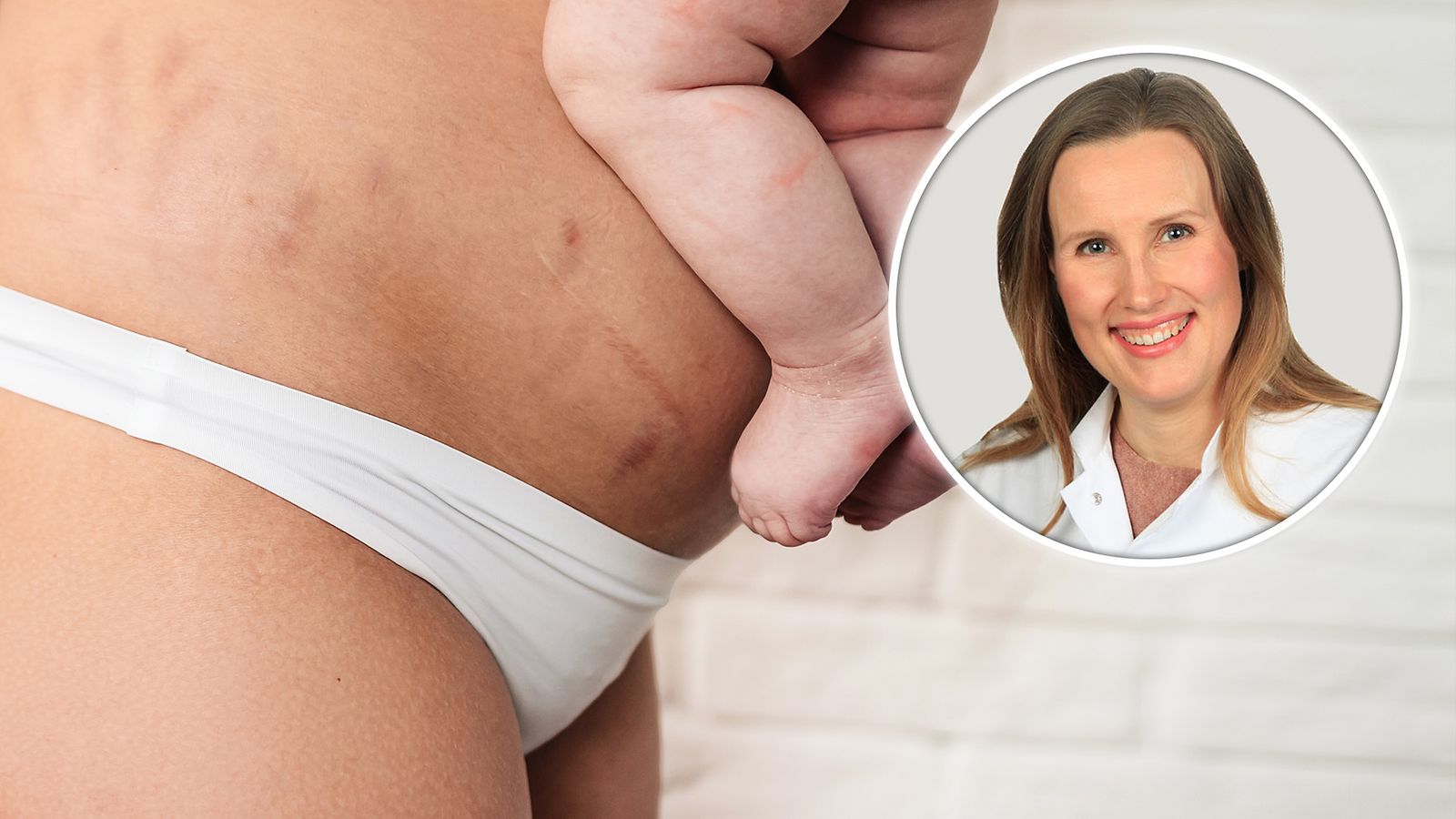 raskaudesta ja synnytyksesta toipuminen, gynekologi Anni Ellenberg
