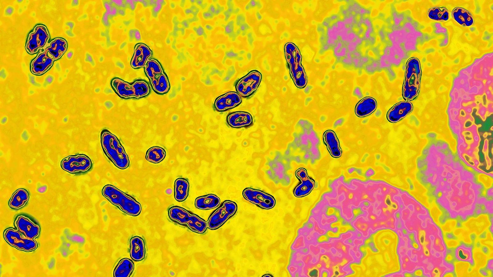 AOP16.1.301641657 rutto bakteeri Yersinia pestis