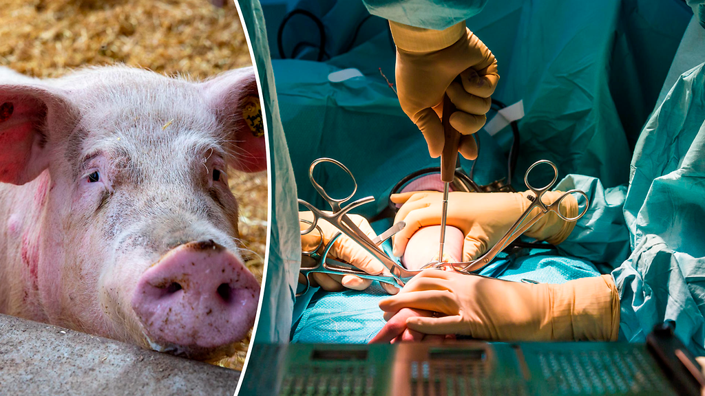 Läpimurto lähellä: Siat voivat pian pelastaa miljoonien sairaiden hengen