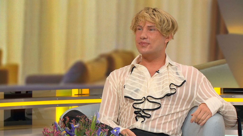 Joni Hesselgren oli yli seitsemän tuntia nukutuksessa kauneusoperaatioiden vuoksi